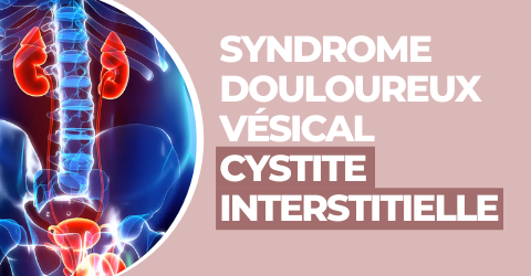 UROLOGIE FEMME (8)