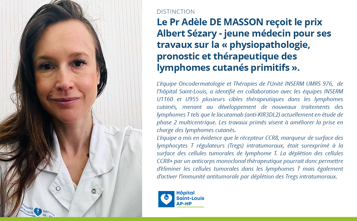prix Adele De Masson